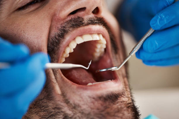 Best Oral Cancer Screening  in Hillandale, MD